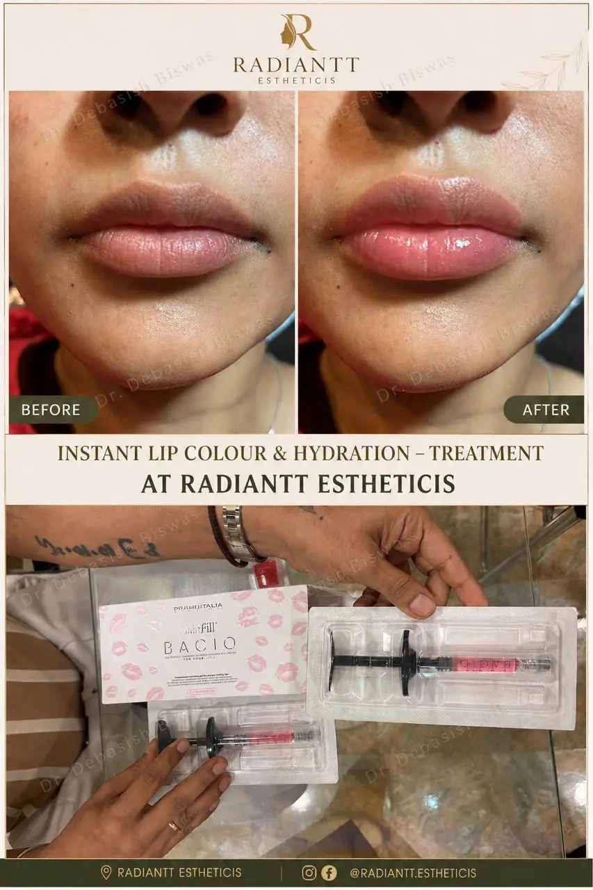 Client result